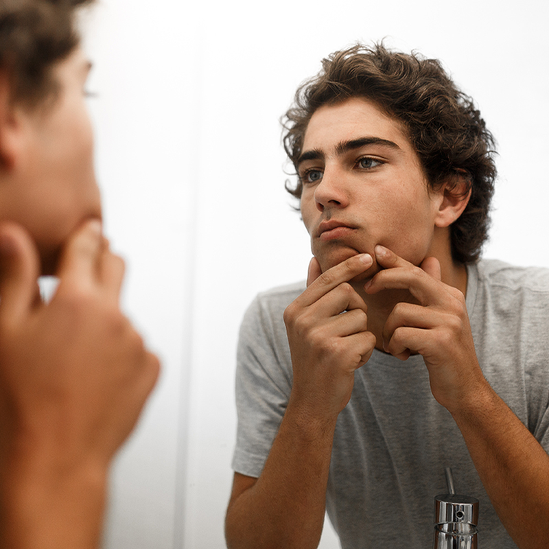 limpiador para el acné 