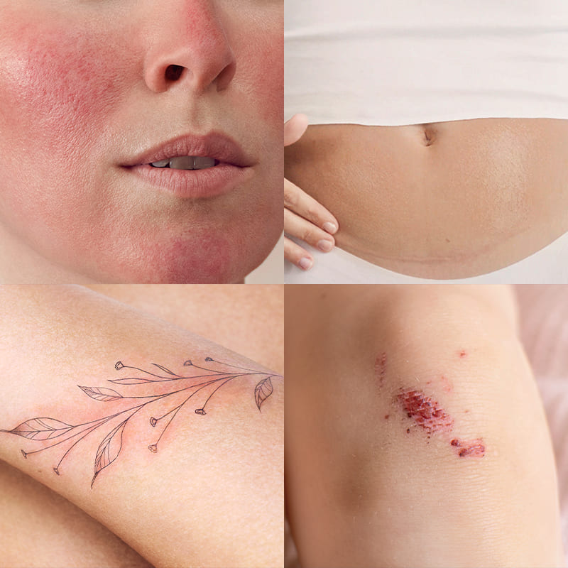 Cicabio Crème+ que cubre más de 25 indicaciones