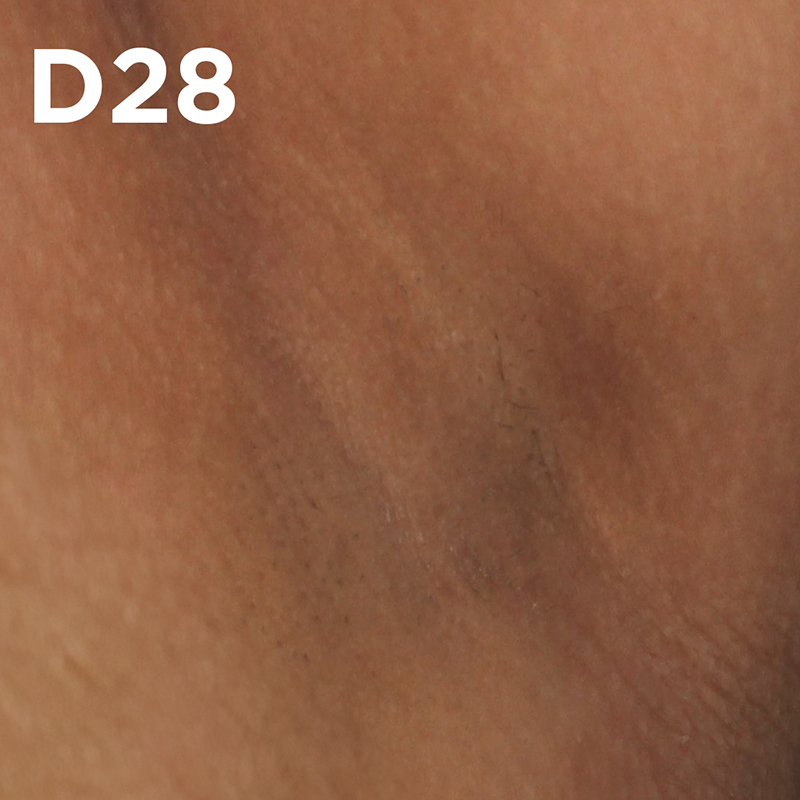 Clínicamente probado y aprobado en manchas oscuras