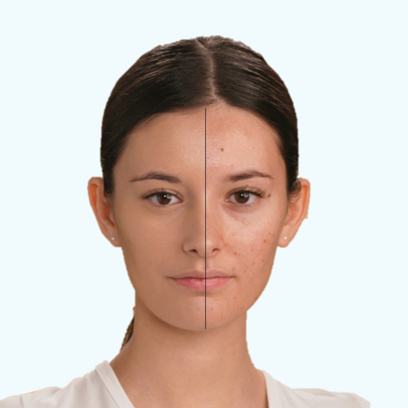 Photoderm cover touch resultados duraderos